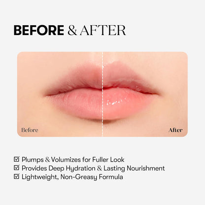 Reedle Shot Lip Plumper, Hydrating & Volumizing Clear Lip Gloss, Microneedling Effect & Hyaluronic Acid for Fuller, Smoother Lips, 0.15 Oz (4.3 G) (Beginner)